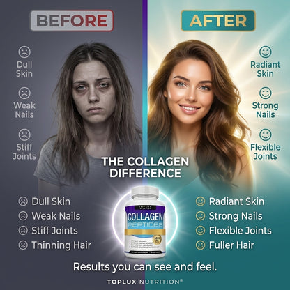 Toplux Multi Collagen Peptides